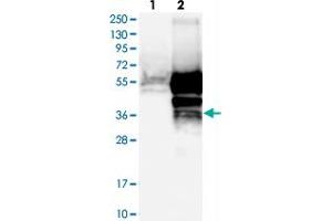 Western blot analysis of Lane 1: Negative control (vector only transfected HEK293T lysate), Lane 2: Over-expression Lysate (Co-expressed with a C-terminal myc-DDK tag (~3. (TMED8 Antikörper)