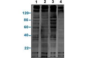 Western blot analysis of a panel of phosphotyrosine antibodies with EGF-stimulated A431 cell lysates. (Phosphotyrosine Antikörper)