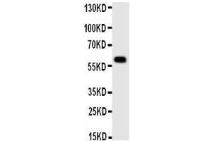 Western Blotting (WB) image for anti-Monoamine Oxidase A (MAOA) (AA 51-69), (N-Term) antibody (ABIN3043133) (Monoamine Oxidase A Antikörper  (N-Term))