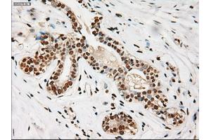 Immunohistochemical staining of paraffin-embedded breast using anti-Notch1 (ABIN2452671) mouse monoclonal antibody. (Notch1 Antikörper  (AA 2300-2556))