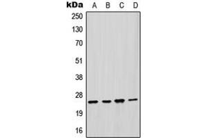 Western blot analysis of GSTM2 expression in HepG2 (A), HeLa (B), mouse liver (C), rat liver (D) whole cell lysates.