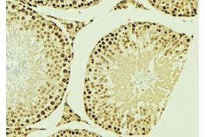 ABIN6276953 at 1/100 staining Mouse testis tissue by IHC-P. (MNAT1 Antikörper  (N-Term))