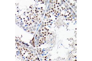 Immunohistochemistry of paraffin-embedded mouse testis using RGS14 Rabbit pAb (ABIN6130669, ABIN6146917, ABIN6146918 and ABIN6225301) at dilution of 1:100 (40x lens). (RGS14 Antikörper  (AA 230-510))