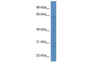 WB Suggested Anti-TBC1D10A Antibody Titration: 0. (TBC1D10A Antikörper  (C-Term))