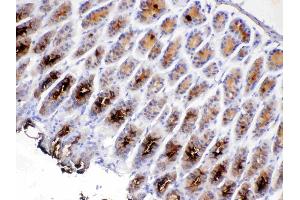 IHC analysis of TFF2 using anti-TFF2 antibody . (Trefoil Factor 2 Antikörper  (AA 24-129))