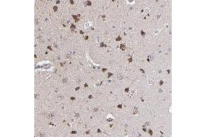 Immunohistochemical staining of human cerebral cortex with MAGEE1 polyclonal antibody  shows strong cytoplasmic positivity in neuronal cells at 1:20-1:50 dilution. (MAGEE1 Antikörper)
