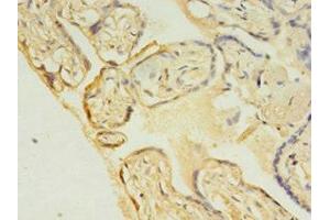 Immunohistochemistry of paraffin-embedded human placenta tissue using ABIN7174430 at dilution of 1:100 (UBE2C Antikörper  (AA 2-179))