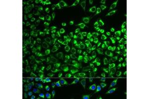 Immunofluorescence analysis of MCF-7 cells using CYP51A1 Polyclonal Antibody (CYP51A1 Antikörper)