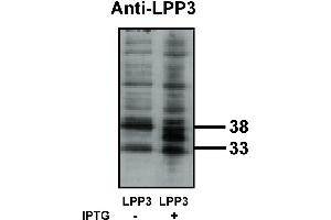 Western blot analysis using LPP3 antibody on bacterially expressed LPP3 protein when untreated (-) and treated with with 0.