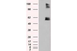 Image no. 2 for anti-Lipase, Endothelial (LIPG) antibody (ABIN1499175)