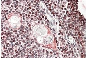 AP23696PU-N SATB1 Antibody staining of of paraffin embedded Human Thymus at 3. (SATB1 Antikörper  (Internal Region))