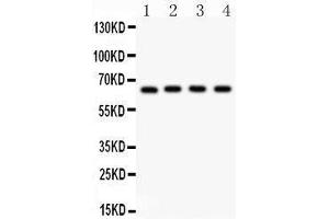 Anti- NF-kB p65 Picoband antibody, Western blotting All lanes: Anti NF-kB p65  at 0. (NF-kB p65 Antikörper  (AA 291-479))
