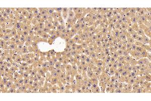 Detection of NNMT in Mouse Liver Tissue using Polyclonal Antibody to Nicotinamide-N-Methyltransferase (NNMT) (NNMT Antikörper  (AA 1-264))