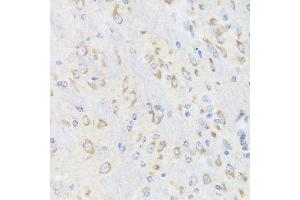 Immunohistochemistry of paraffin-embedded mouse brain using CHIC2 antibody at dilution of 1:100 (x40 lens).