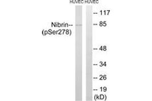 Western blot analysis of extracts from HuvEc cells treated with Forskolin 40nM 30', using Nibrin (Phospho-Ser278) Antibody.