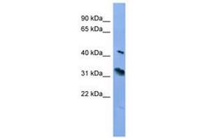 Image no. 1 for anti-Rhodopsin (RHO) (C-Term) antibody (ABIN6746706) (Rhodopsin Antikörper  (C-Term))