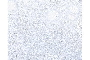 Immunohistochemistry (IHC) image for anti-Cytotoxic T-Lymphocyte-Associated Protein 4 (CTLA4) (C-Term) antibody (ABIN7795650)