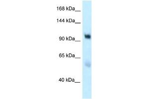 WB Suggested Anti-EDEM3 Antibody Titration: 1. (EDEM3 Antikörper  (C-Term))