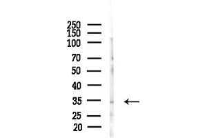 Western blot analysis of lysates from A375 cells(starvation,24h treatment), using CCDC28A Antibody at 1/1000 dilution.