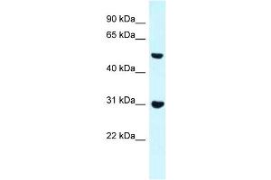 WB Suggested Anti-Fnbp1 Antibody Titration: 1.