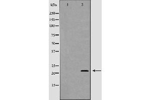 Western blot analysis of Hela cell lysate, using GPX4 Antibody.