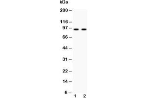 Western blot testing of Cadherin 17 antibody and Lane 1:  HeLa;  2: SW620 lysate (LI Cadherin Antikörper  (AA 686-699))