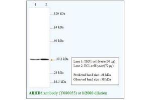 Image no. 1 for anti-Abhydrolase Domain Containing 6 (ABHD6) antibody (ABIN791375) (ABHD6 Antikörper)