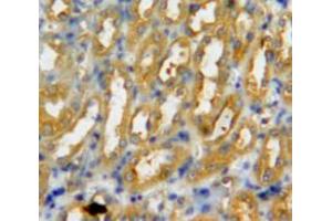 Immunohistochemistry (IHC) image for anti-Peptidyl Arginine Deiminase, Type III (PADI3) (AA 1-300) antibody (ABIN5014074)