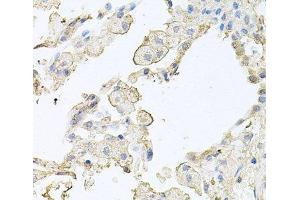 Immunohistochemistry of paraffin-embedded Human lung using MMRN1 Polyclonal Antibody at dilution of 1:100 (40x lens). (Multimerin 1 Antikörper)