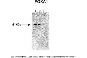 Sample Type: 1. (FOXA1 Antikörper  (N-Term))