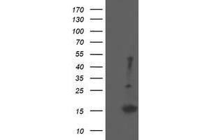 Image no. 3 for anti-Eukaryotic Translation Initiation Factor 5A2 (EIF5A2) antibody (ABIN1497997) (EIF5A2 Antikörper)