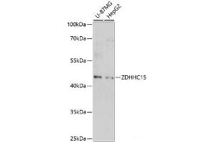 Western blot analysis of extracts of various cell lines using ZDHHC15 Polyclonal Antibody at dilution of 1:1000.