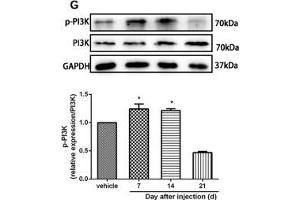 The CXCR7 and PI3K/Akt signaling pathways are involved in CPSP in the dorsal horn of the spinal cord. (GAPDH Antikörper)