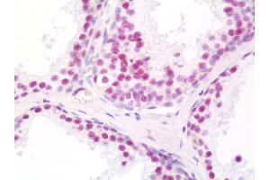 Anti-THRAP3 / TRAP150 antibody IHC staining of human prostate.