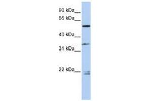 Image no. 1 for anti-Dihydropyrimidinase-Like 2 (DPYSL2) (AA 432-481) antibody (ABIN6743605) (DPYSL2 Antikörper  (AA 432-481))