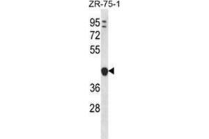 YIPF1 Antibody (N-term) western blot analysis in ZR-75-1 cell line lysates (35 µg/lane). (YIPF1 Antikörper  (N-Term))