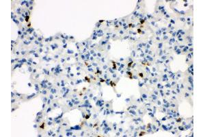 Immunohistochemistry (IHC) image for anti-Wingless-Type MMTV Integration Site Family, Member 7A (WNT7A) (AA 226-256), (C-Term) antibody (ABIN3042348)