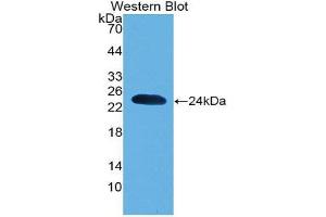 Western Blotting (WB) image for anti-Parkinson Protein 7 (PARK7) (AA 1-189) antibody (ABIN1078423) (PARK7/DJ1 Antikörper  (AA 1-189))