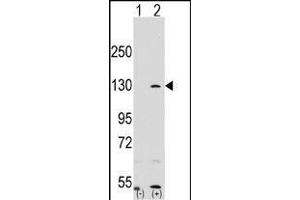 Western blot analysis of RP1 (arrow) using rabbit polyclonal RP1 Antibody (N-term) (ABIN390353 and ABIN2840765). (PARP1 Antikörper  (N-Term))