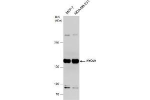 WB Image HYOU1 antibody detects HYOU1 protein by western blot analysis.