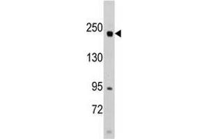 Western blot analysis of anti-RICTOR Pab in SK-BR-3 cell line lysates (35 µg/lane). (RICTOR Antikörper  (N-Term))