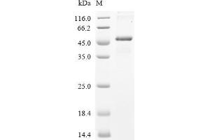 Fibronectin 1 (FN1) (AA 32-404) protein (His tag)