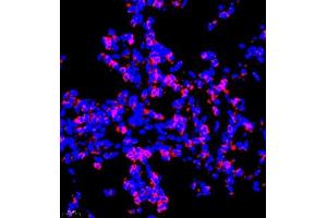 Immunofluorescence of paraffin embedded rat lung using P4H (ABIN7074215) at dilution of 1:700 (400x lens) (HIF Prolyl Hydroxylase Antikörper)