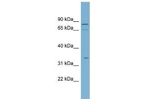WB Suggested Anti-SLC5A9 Antibody Titration:  0. (SLC5A9 Antikörper  (N-Term))