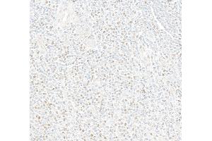 Immunohistochemistry (IHC) image for anti-Myocyte Enhancer Factor 2C (MEF2C) (AA 425-475) antibody (ABIN7795747) (Rekombinanter MEF2C Antikörper  (AA 425-475))