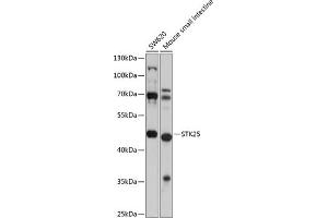 Western blot analysis of extracts of various cell lines, using STK25 antibody (ABIN6132842, ABIN6148604, ABIN6148605 and ABIN6225078) at 1:1000 dilution. (STK25 Antikörper  (AA 297-426))