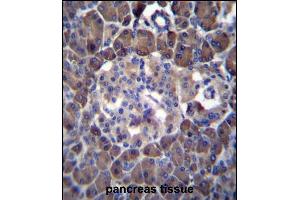 MLM Antibody (C-term) (ABIN6242125 and ABIN6577331) immunohistochemistry analysis in formalin fixed and paraffin embedded human pancreas tissue followed by peroxidase conjugation of the secondary antibody and DAB staining. (Cutaneous Malignant Melanoma/dysplastic Nevus Antikörper  (C-Term))