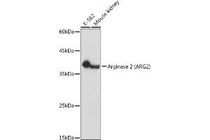 Western blot analysis of extracts of various cell lines, using Arginase 2  antibody (ABIN6131236, ABIN6137078, ABIN6137079 and ABIN6221969) at 1:1000 dilution. (ARG2 Antikörper  (AA 1-354))