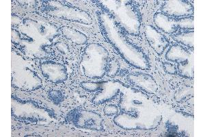 Immunohistochemistry (IHC) image for anti-Dipeptidyl-Peptidase 4 (DPP4) (Internal Region) antibody (ABIN190769)