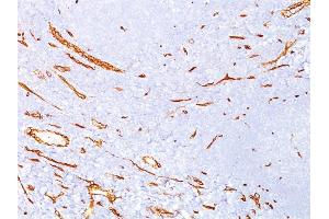 Formalin-fixed, paraffin-embedded human tonsil stained with CD34 Mouse Monoclonal Antibody (QBEnd/10). (CD34 Antikörper)
